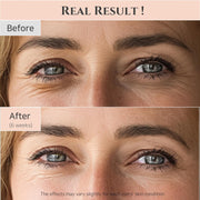 Revive Eye Serum : Ginseng + Retinal 30ml